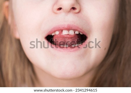 Close up portrait of a smiling happy little child girl with long hair moving her milk front tooth with her tongue in open mouth. Milk teeth loss concept