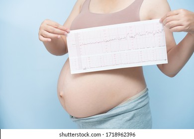 Close up Pregnant woman holding ctg graph in hand on blue background. Waiting baby concept.