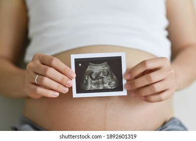 Close Up Pregnant Woman Holding Ultrasound Scan Photo On Her Belly. Mother With Sonogram Of Her Unborn Baby. Concept Of Pregnancy, Maternity Prenatal Care