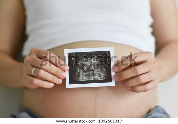 Close up Pregnant woman holding\
ultrasound scan photo on her belly. Mother with sonogram of her\
unborn baby. Concept of pregnancy, Maternity prenatal\
care