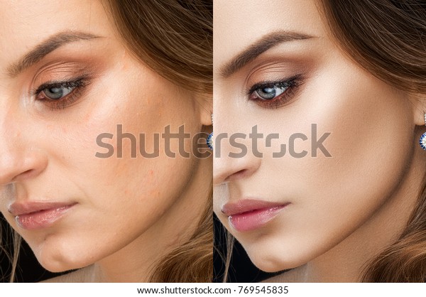 Close up of result of retouch photography\
beautiful brunette woman. Collage with after and before. Perfect\
skin, bronze sunburn, long eyelashes, plump lips after retouch.\
Clean skin and bright\
makeup.