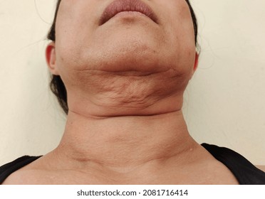 close up the sagging skin under the neck, fat layer under the chin, problem wrinkle of woman.