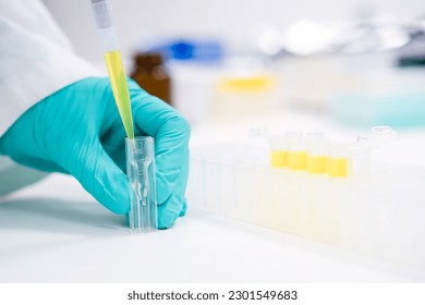 Close up scientist hands uses an automatic pipette to fill the solution to microcuvette. Chemical Laboratory or analysis of urinalysis 