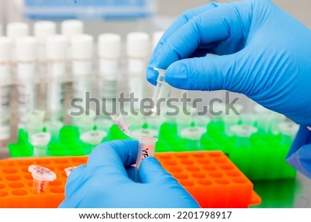 Close up of scientist hands while extracting DNA using the spin column-based nucleic acid purification technique