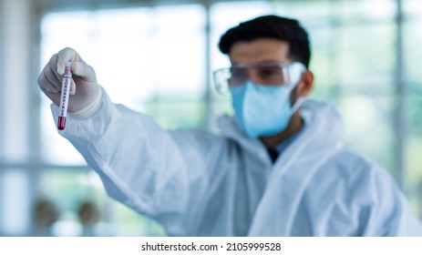 Close Up Shot Of Caucasian Professional Bearded Male Scientist In White Ppe Lab Coat Safety Goggles And Face Mask Holding Looking At Blood Sample Test Tube In Hand With Laboratory Science Equipment.