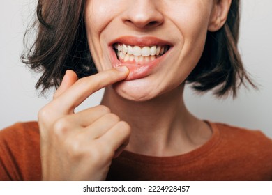 Close up shot of gum inflammation. Cropped shot of a young woman showing red bleeding gums isolated on a gray background. Dentistry, dental care
