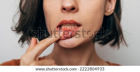 Close up shot of gum inflammation. Cropped shot of a young woman showing red bleeding gums isolated on a gray background. Dentistry, dental care