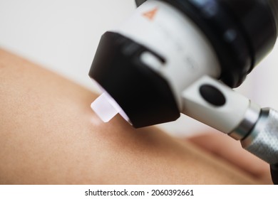 Close Up Shot Of Modern Dermatology Skin Check Up With Digital Deramatoscope. Dermoscopy Microscope Procedure And Skin Cancer Prevention Treatment. 