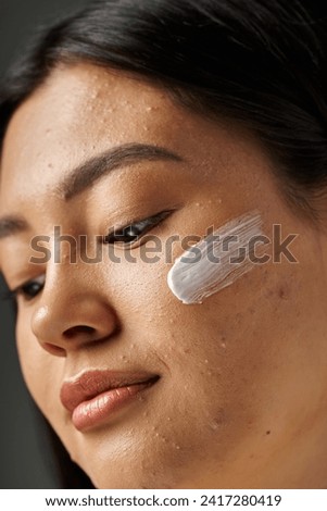 close up shot of young asian woman with brunette hair and treatment cream on acne prone skin
