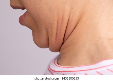 A close up and side profile view of a young Caucasian woman pushing her chin towards her chest, revealing rolls of loose skin and fat, aka a turkey neck.