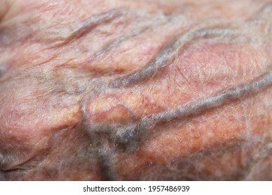 Close up of skin of hand of old 90 year old woman grandmother.