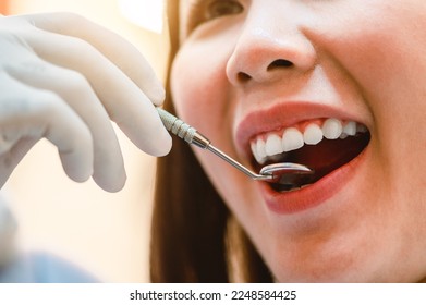 Close up smiling in dental clinic.Dentist examining teeth patients in clinic for better dental health and a bright smile.Hygienist concept of a healthy and beautiful smile. - Shutterstock ID 2248584425