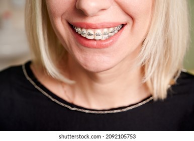 Close up of smiling patient showing white straight teeth with orthodontic brackets. Woman demonstrating results of dental braces treatment. Concept of dentistry, dental care and orthodontic treatment.
