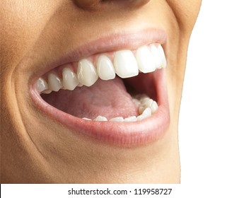 Close Up Of Smiling Teeth Isolated On White Background