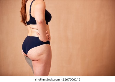 Close Up Studio Shot Of Natural Woman With Prosthetic Limb In Underwear Promoting Body Positivity