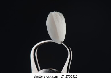 Close up super thin dental porcelain laminated veneer measurement with vernier caliper to show the thickness of veneer for smile makeover treatment.