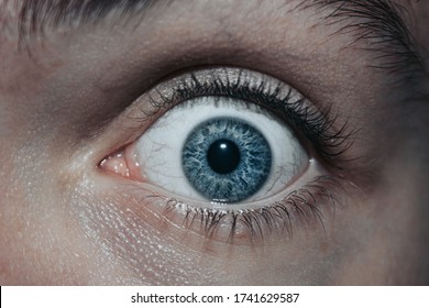 Close Up Of Surprised Scared Look. Close Up Of Eye. Blue Eye With Veins. 