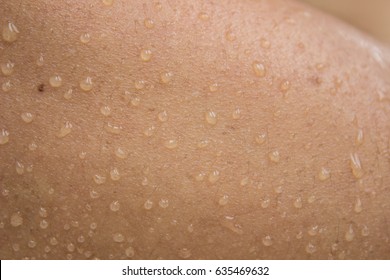 Close Up Of Sweat Or Water Drops On Surface Of Woman Arm Skin, Sweat Release From Sweat Gland For Evaporation Body Heat. Show Concept Of Skin Tanned By Sun Light.