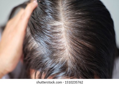 Scalpe Images Stock Photos Vectors Shutterstock