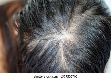 Scalpe Images Stock Photos Vectors Shutterstock
