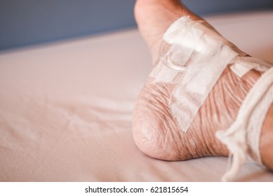 Close Up Toe Of Older Woman Patient In Hospital With Saline Intravenous (iv)