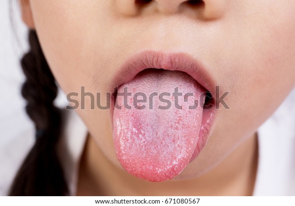 アジア人のかわいい女の子の口を開けて舌を接写 の写真素材 今すぐ編集