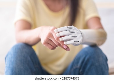 Close Up Two Hands Of Woman With Bionic Arm, Person Lost Her Arm, Girl Artificial Prosthetic Limb