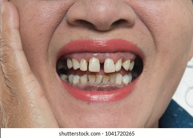 world's ugliest teeth