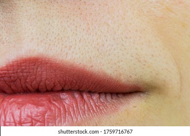 Close Up Of Unwanted Hair In Upper Lip Area Of A Woman