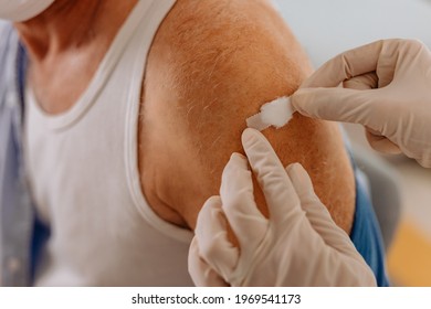 Close Up, Arm After Vaccination, Nurse Putting Cotton Ball On The Place.