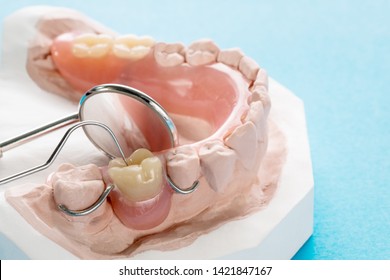 Close up, Artificial removable partial denture or temporary partial denture on blue ground.