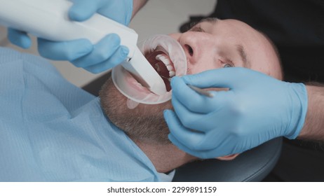 Close up: Doctor scans the teeth of a male patient in the medical office of clinic. The dentist holds in his hand a manual 3D scanner for the jaw and mouth. Dental health. Creates a 3D model of teeth