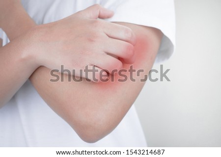 Close up, hands scratching arms from itching, insect bites, skin on a white background. Health care concept.