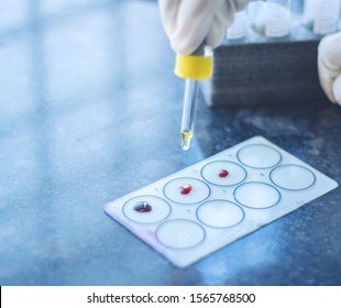 Close up, Hands testing Blood group called Protocol of ABO Blood grouping or testing, Adding Antisera to the blood drops on glass slide.