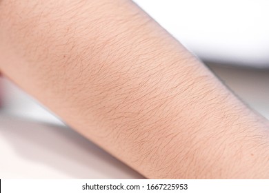 CLOSE UP, MACRO, Makes Unknown Caucasian Person Get Goosebumps. Raised Arm Hair.