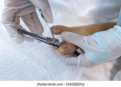 Close Up,Hand Of Caregiver Hold A Nail Clipper,cutting The Ingrown Nail For Senior Grandmother,asian Nurse Help To Cut The Toe Nail For The Old Elderly At Nursing Home,pedicure,foot Nail Care,hygiene