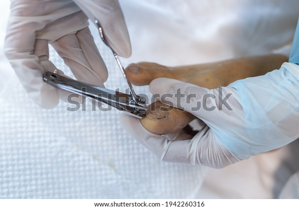 Close up,Hand of caregiver hold a nail\
clipper,cutting the ingrown nail for senior grandmother,asian nurse\
help to cut the toe nail for the old elderly at nursing\
home,pedicure,foot nail\
care,hygiene