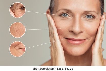 Close ups of wrinkles and skin imperfection on the face of a senior woman. Portrait of beautiful senior woman touching her perfect skin after a beauty treatment. Aging process concept. - Powered by Shutterstock