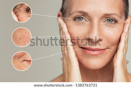 Close ups of wrinkles and skin imperfection on the face of a senior woman. Portrait of beautiful senior woman touching her perfect skin after a beauty treatment. Aging process concept.