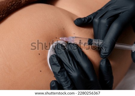 Close View of the Beautician Hands Makes Injections to Burn Fat on the Butt of a Woman. Lady's Aesthetic Cosmetology in a Beauty Salon. Cosmetology
