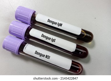 Close view of blood samples for dengue virus (IgG, IgM and NS1) test, Antibody and antigen testing for dengue virus