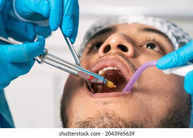 Close up view of a dentist's hands injecting anaesthesia into a patient's mouth in a dental clinic