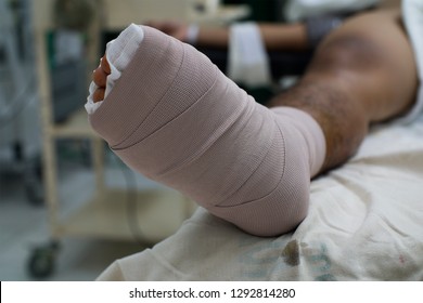 Close Up View Of A Diabetic Foot With Bandage After Surgery.