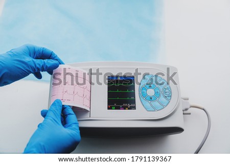 Close up view of ECG machine display and print out trip chart indicating pulse tare and condition of patient