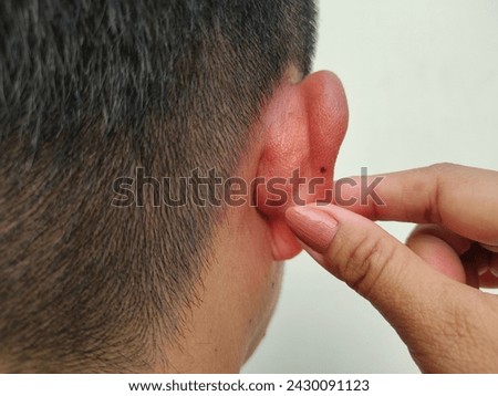 Close up view of hand holding back ear with fleck,  male breasts, shirtless, red acne skin, black head, abdominal distension, specific fingers, Isolate on white background and health care concept.