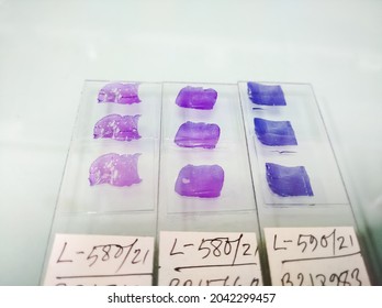 Close view of Histopathology slides stained with hematoxylin and eosin or HE stain, ready for microscopic examination with selective focus on slides, Histology