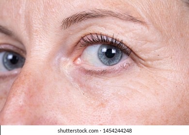 A Close Up View On The Blue Eye Of A Caucasian Woman In Her Early Forties. Details Of The Laughter Lines And Crow's Feet. Natural Aging Of The Human Face.