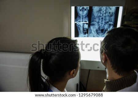 Close up  view: picture of two doctors exploring spinal x-ray: lumbar and cervical region - first 2 cervical vertebrae (axis and atlas), coxofemural joint