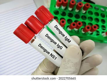 Close view of technician or technologist hand hold blood samples for dengue virus (IgG, IgM and NS1) test, with lab background. Antibody and antigen testing for dengue virus
