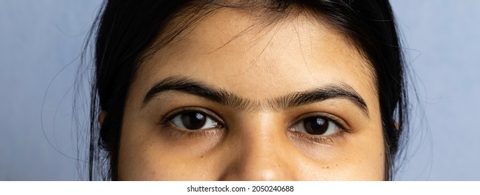 Close Up View Of Unibrow Of A Woman